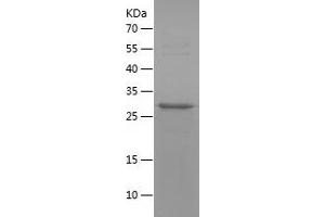 Hepatocyte Growth Factor alpha Chain (AA 85-157) protein (His-IF2DI Tag)