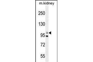 Nephrin  antibody (ABIN654375 and ABIN2844129) western blot analysis in mouse kidney tissue lysates (35 μg/lane). (Nephrin antibody  (Tyr1210))