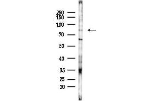 anti-Kinesin Family Member 2C (KIF2C) (C-Term) antibody
