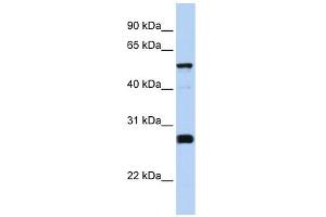 GPRASP2 antibody used at 1 ug/ml to detect target protein. (GPRASP2 antibody  (Middle Region))