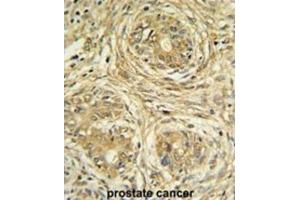 Immunohistochemistry (IHC) image for anti-Suppressor of Var1, 3-Like 1 (SUPV3L1) antibody (ABIN3004313) (SUPV3L1 antibody)