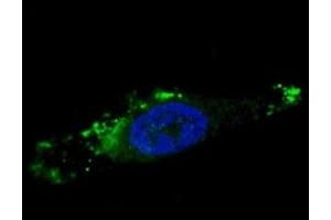 Fluorescent image of chloroquine-treated U251 cells stained with ATG12 antibody. (ATG12 antibody  (AA 1-30))
