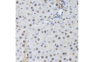 Immunohistochemistry (Paraffin-embedded Sections) (IHC (p)) image for anti-Retinoblastoma Binding Protein 4 (RBBP4) antibody (ABIN2989757)