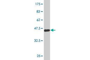 Western Blotting (WB) image for anti-CDC42 Binding Protein Kinase beta (DMPK-Like) (CDC42BPB) (AA 1580-1679) antibody (ABIN523072)