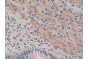 DAB staining on IHC-P; Samples: Mouse Uterus Tissue (ROCK1 antibody  (AA 1094-1323))