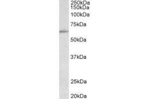 Western Blotting (WB) image for anti-Hypermethylated in Cancer 2 (HIC2) (Internal Region) antibody (ABIN2465146)