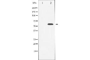 Western blot analysis of RUNX2 expression in HeLa cells,The lane on the left is treated with the antigen-specific peptide. (RUNX2 antibody  (Internal Region))