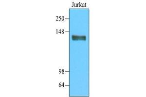 Cell lysates of Jurkat(20 ug) were resolved by SDS-PAGE, transferred to nitrocellulose membrane and probed with anti-human CD45 (1:2000). (CD45 antibody  (AA 1029-1249))