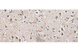 Immunohistochemistry of paraffin-embedded Human brain tissue using METAP1D Polyclonal Antibody at dilution of 1:60(x200)