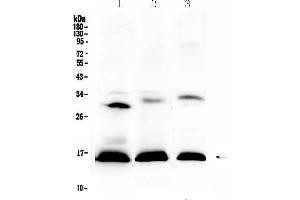 Western blot analysis of HBD using anti-HBD antibody . (HBd antibody  (AA 2-147))