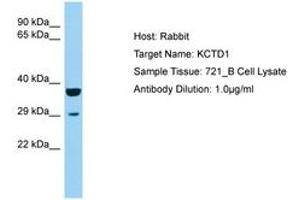 Image no. 1 for anti-Potassium Channel Tetramerisation Domain Containing 1 (KCTD1) (AA 110-159) antibody (ABIN6750204) (KCTD1 antibody  (AA 110-159))
