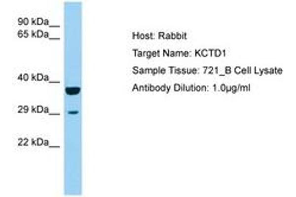 KCTD1 anticorps  (AA 110-159)