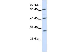 WB Suggested Anti-RDM1 Antibody Titration: 0.