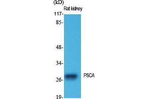 Western Blot (WB) analysis of specific cells using PSCA Polyclonal Antibody. (PSCA antibody  (Internal Region))