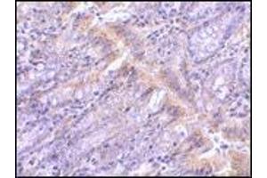 AP20061PU-N PIST antibody staining of Rat Colon tissue by Immunohistochemistry at 1 μg/ml. (GOPC antibody  (Middle Region))