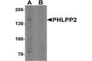 Western blot analysis of PHLPP2 in SW480 cell lysate with PHLPP2 Antibody  at 1 μg/ml in (A) the presence and (B) the absence of blocking peptide. (PHLPP2 antibody  (C-Term))