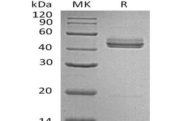 IL23 Protein