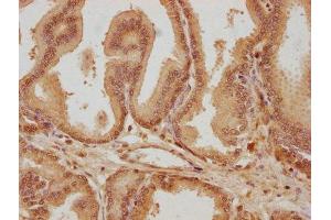 IHC image of ABIN7145007 diluted at 1:300 and staining in paraffin-embedded human prostate tissue performed on a Leica BondTM system. (SUPV3L1 antibody  (AA 499-786))