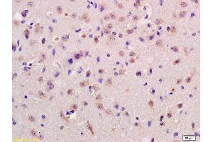 Formalin-fixed and paraffin embedded rat brain labeled with Anti-GPCR GPR37 Polyclonal Antibody, Unconjugated (ABIN1713825) at 1:200 followed by conjugation to the secondary antibody and DAB staining. (GPR37 antibody  (AA 201-300))
