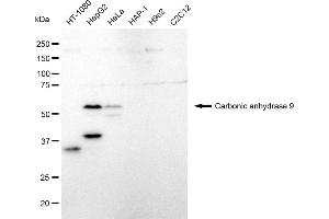 Western blotting analysis using Carbonic anhydrase 9 antibody (ABIN7797869).