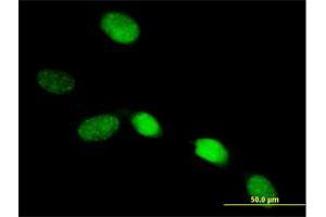 Immunofluorescence of purified MaxPab antibody to SOX13 on HeLa cell. (SOX13 antibody  (AA 1-622))