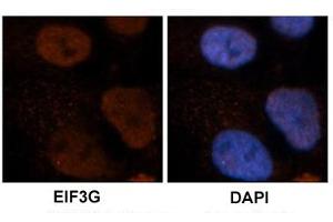 Immunohistochemical staining of human brain stem cells with EIF3G polyclonal antibody . (EIF3G antibody  (AA 218-267))