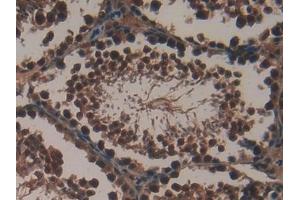 Immunohistochemistry (IHC) image for anti-X-Ray Repair Complementing Defective Repair in Chinese Hamster Cells 6 (XRCC6) (AA 319-538) antibody (ABIN7431623)