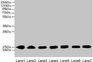Western blot All lanes: CYB5B antibody at 0.