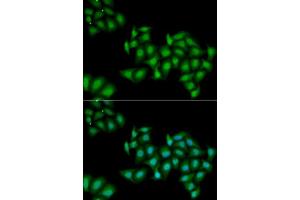 Immunofluorescence analysis of MCF7 cells using DDX1 antibody. (DDX1 antibody  (AA 441-740))