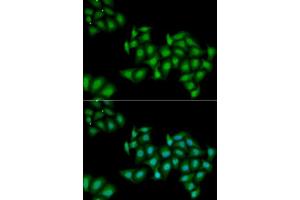 Immunofluorescence analysis of MCF7 cells using DDX1 antibody. (DDX1 antibody  (AA 441-740))