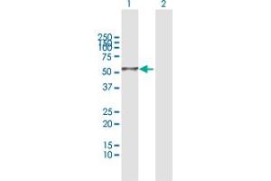 Western Blot analysis of DEPDC7 expression in transfected 293T cell line by DEPDC7 MaxPab polyclonal antibody. (DEPDC7 antibody  (AA 1-511))