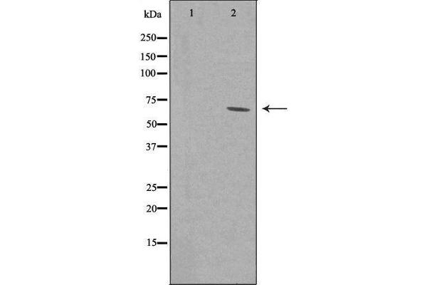 ZNF460 antibody  (C-Term)