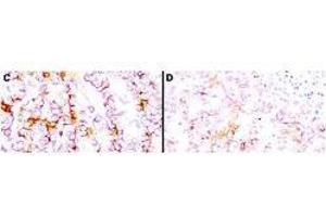 Immunohistochemistry using  anti-mesothelin antibodies to detect mesothelin in PEFF human tissue sections treated by antigen retrieval methods. (Mesothelin antibody  (Extracellular, Extracellular Domain))