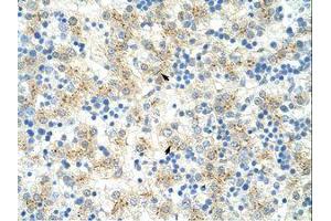 Image no. 2 for anti-Exosome Component 6 (EXOSC6) (N-Term) antibody (ABIN202141)