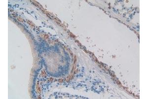 Immunohistochemistry (IHC) image for anti-Endothelin 1 (EDN1) (AA 33-202) antibody (ABIN7429730)