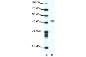 WB Suggested Anti-FLI1  Antibody Titration: 1. (FLI1 antibody  (N-Term))