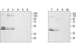 Western blot analysis of rat hippocampus, DRG (lanes 2 and 5), brain (lanes 3 and 6), mouse brain (lanes 7 and 9) and human prostate carcinoma LNCaP cell lysates: - 1,2,3,7,8. (GALR2 antibody  (3rd Intracellular Loop))