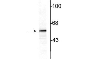 Western blot of 10ug of rat striatal lysate showing specific immunolabeling of the ~60 kDa tyrosine hydroxylase protein. (Tyrosine Hydroxylase antibody)