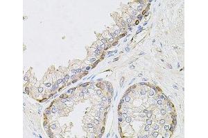 Immunohistochemistry of paraffin-embedded Human prostate using CIB1 Polyclonal Antibody at dilution of 1:100 (40x lens). (CIB1 antibody)