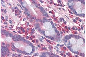 Human Small Intestine: Formalin-Fixed, Paraffin-Embedded (FFPE) (DPF2 antibody  (AA 56-155))