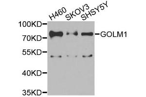 Western blot analysis of extracts of various cell lines, using GOLM1 antibody (ABIN5974385) at 1/1000 dilution. (GOLM1 antibody)