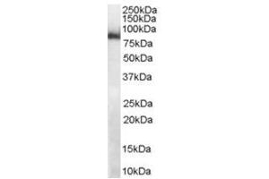 Image no. 2 for anti-Midline 2 (MID2) (C-Term) antibody (ABIN374299) (Midline 2 antibody  (C-Term))