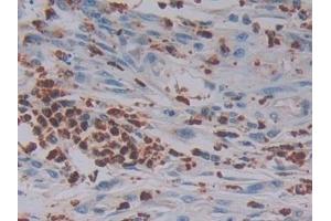 Immunohistochemistry (IHC) image for anti-Granzyme B (GZMB) (AA 21-247) antibody (ABIN7432145)