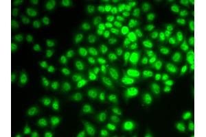 Immunofluorescence analysis of HeLa cells using CCNG1 antibody (ABIN6290270). (Cyclin G1 antibody)