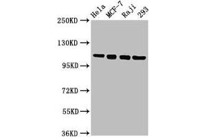 Western Blot Positive WB detected in: Hela whole cell lysate, MCF-7 whole cell lysate, Raji whole cell lysate, 293 whole cell lysate All lanes: MCM2 antibody at 4. (MCM2 antibody  (AA 2-904))