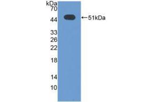 Western blot analysis of recombinant Human ATF3. (ATF3 antibody  (AA 1-181))