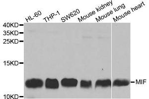 Western blot analysis of extracts of various cell lines, using MIF antibody. (MIF antibody  (AA 1-115))