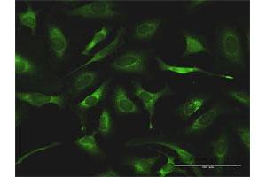 Immunofluorescence (IF) image for anti-Glutaminyl-tRNA Synthetase (QARS) (AA 1-775) antibody (ABIN519576)