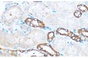 Immunohistochemistry of paraffin-embedded Mouse kidney using PIK3CA Polyclonal Antibody at dilution of 1:100 (40x lens). (PIK3CA antibody)
