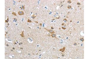 The image on the left is immunohistochemistry of paraffin-embedded Human brain tissue using ABIN7190915(HCN4 Antibody) at dilution 1/20, on the right is treated with synthetic peptide. (HCN4 antibody)